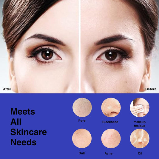 Before and after image showing skin improvement with Rechargeable Facial Cleansing Brush results.