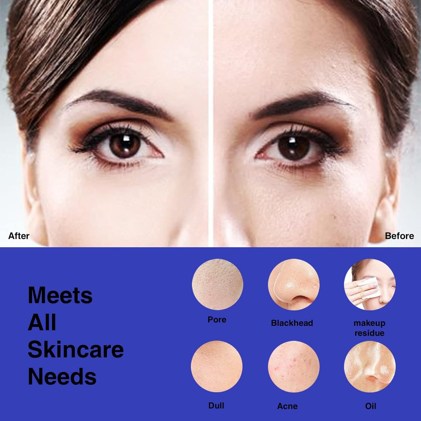 Before and after image showing skin improvement with Rechargeable Facial Cleansing Brush results.